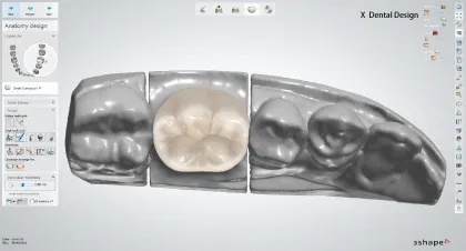 Expert Dental Design Service