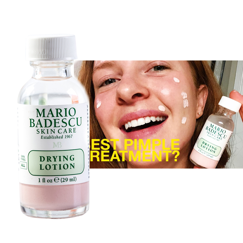 Acne SOS Mario Badescu Drying Lotion 29ml 1oz Effective Acne Spot Treatment