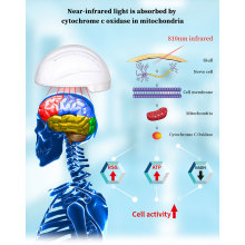 810nm Brain Therapy Machine Neuronic Therapeutic Device