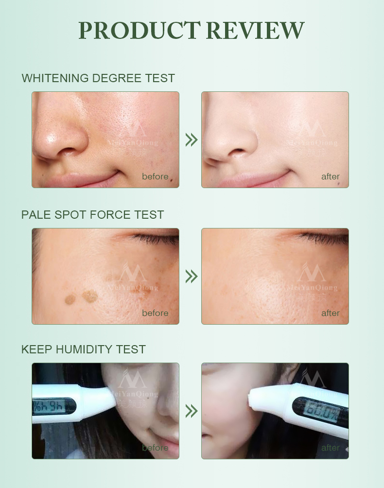 Meiyanqiong Anti Aging Face Care Cream Dark Spot Remover Skin Lightening Cream Dark Skin Care Anti Freckle Whitening Cream TSLM2