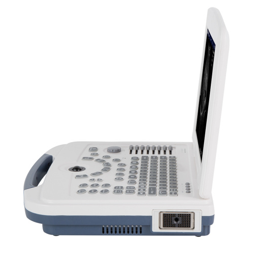 Mesin Ultrasound Laptop Full-Digital UW-580