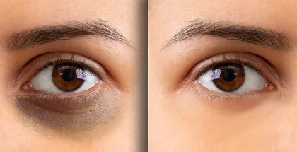 Beauty roller face device massaging beauty