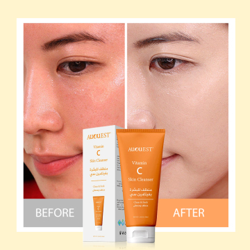 Private Label Organic Vitamin C Facial Cleanser with Deep Cleansing, Dark Spot Reduction, and Whitening Properties