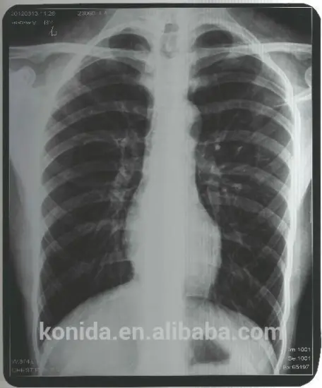 medical supplies xray machine camera film blue