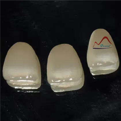 Dental All Ceramics CC Veneers