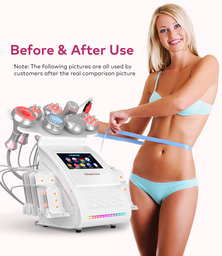 Omeina lipo laser slimming machine