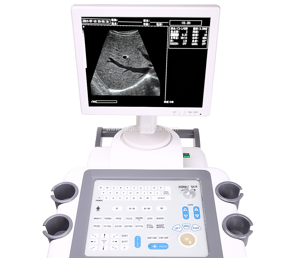 B/W Trolley Ultrasound Scanner Good Price Ultrasound Machine