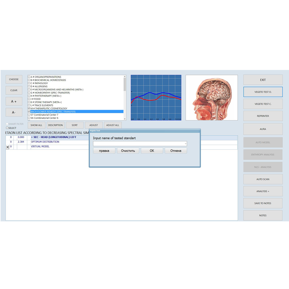 bioresonance aura analyzer diagnostic machine