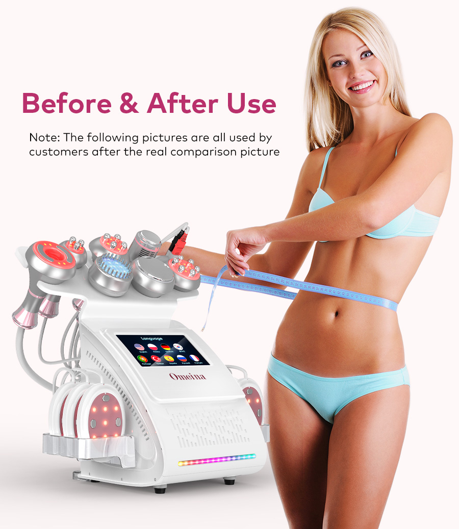 Omeina nine in one cavitation machine with ems