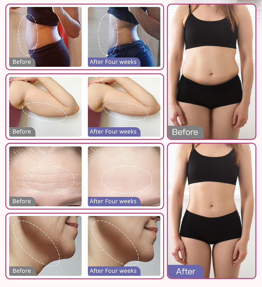 Body Sculpting Machine_14