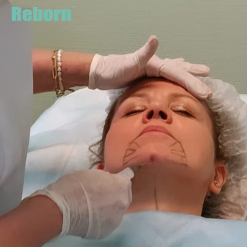 Βιολογική διέγερση PLLA Filler για plumping