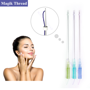 2017 Hot Sale PDO Thread Lift Nasolabial