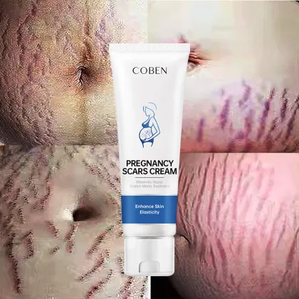 Private Label Female Body Stretch Mark Removal Lotion