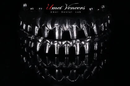 Biocompatible Titanium Marlow Bridge