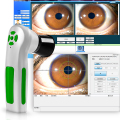 12MP Iriscope Iris Analyzer iridology analyzer system