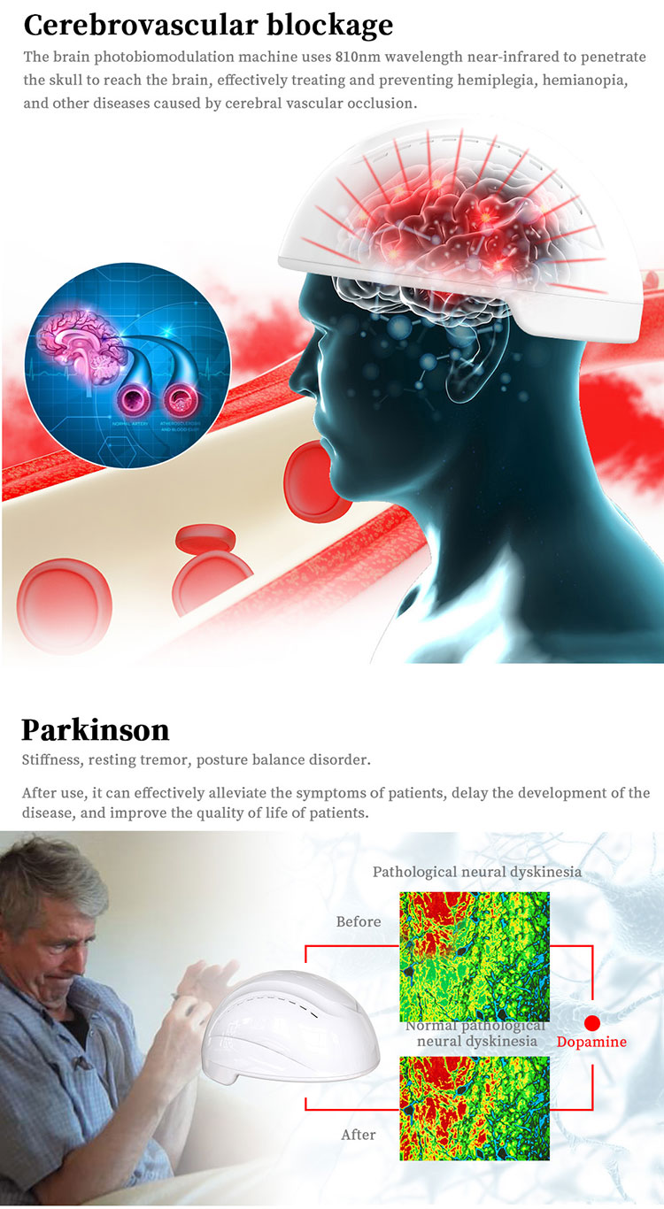 810nm Brain Therapy Machine Neuronic Therapeutic Device