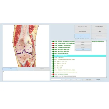 bioresonance aura analyzer diagnostic machine