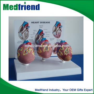 Medical Heart Anatomical Model for Education Use