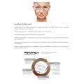 profhilo decolletage hafiller hands arms neck under eyes