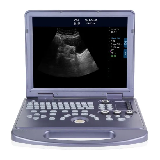 High-End PC-Based Portable Ultrasound Scanner for Hospital Equipment and Human Use