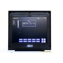 Мужчынскі інструмент ультрагукавога дыягностыкі ў жоўцевай камені