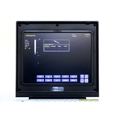 Мужчынскі інструмент ультрагукавога дыягностыкі ў жоўцевай камені