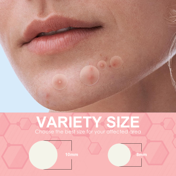 PROPRIETÀ DI PROPRIETÀ ACNE IDROCOLOID PIMPLE