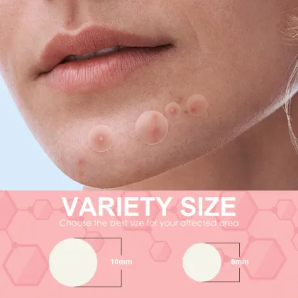 Private Label Hydrocolloid Acne Pimple Patches