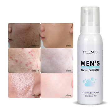 Pengelupasan mousse asid amino mencuci muka untuk lelaki