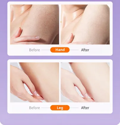 Dr. Dome Niacinamide VC Body Moisturizing Cream