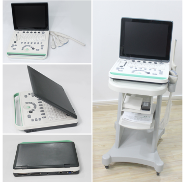 2D Laptop Black White Ultrasound Scanner