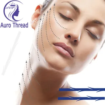 Bidirectional Blunt 3D Cog Thread Lift for Face