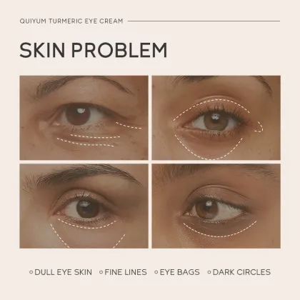 Luxury Turmeric Eye Cream - Anti-Wrinkle, Brightening, Lift & Firm Eye Bags Removal 15g