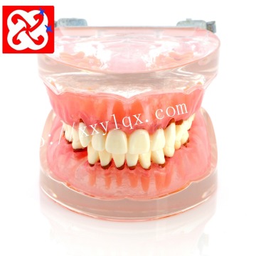 Model demonstrasi periodontal dengan resesi kalkulus dan gingiva