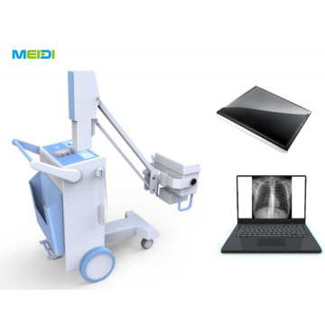 Digital Radiography DR Xray System