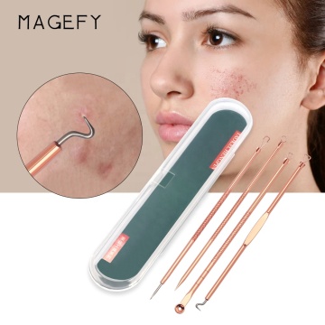 Blackhead Removal Kit - Personalized Facial Care Acne Needle Tool Set (Rose Gold, 4 Pcs Stainless Steel)