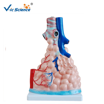 Model Alveoli Paru yang Diperbesar