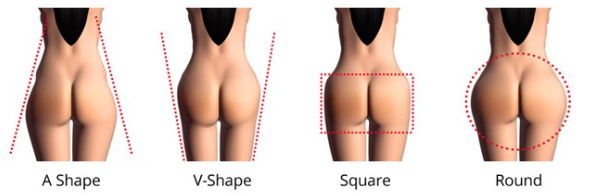 Hydrogel Buttock Injection