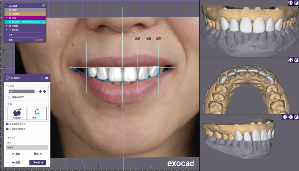 Dentalcadscreenshot4 Png