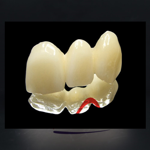 High Quality Dental IPS Emax Cosmetic Crown All Ceramics