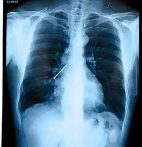 cr x-ray system medical equipment fuji drypix 2000