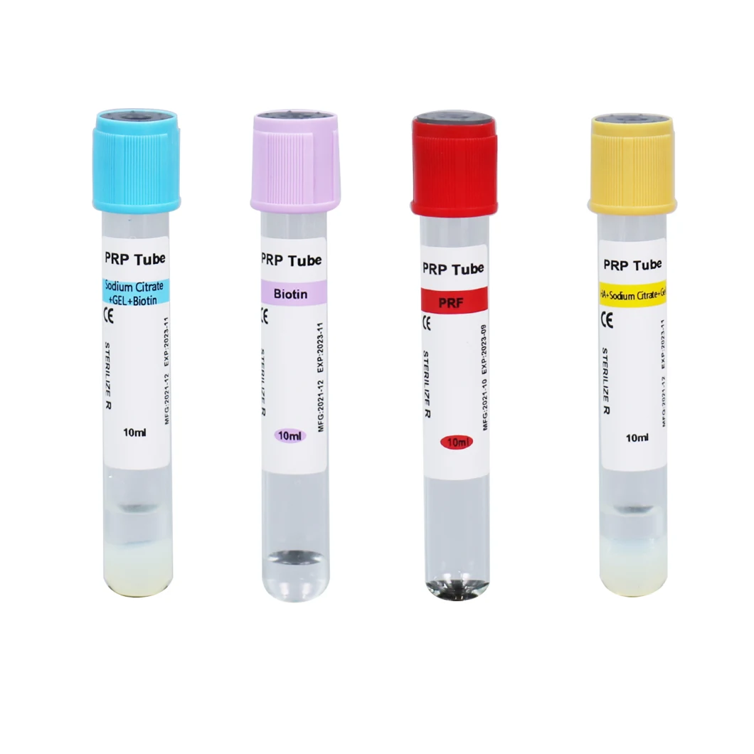 Anticoagulación del tubo PRP del fabricante y tubo de gel PRP 8-15 ml utilizado para la terapia PRP