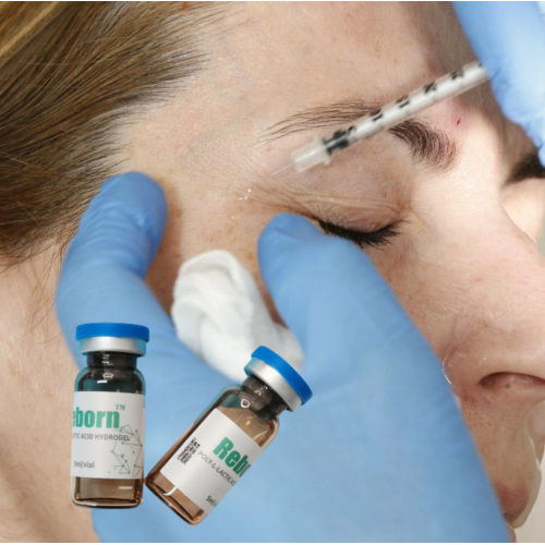 injectable fillers to treat puffy eyelids