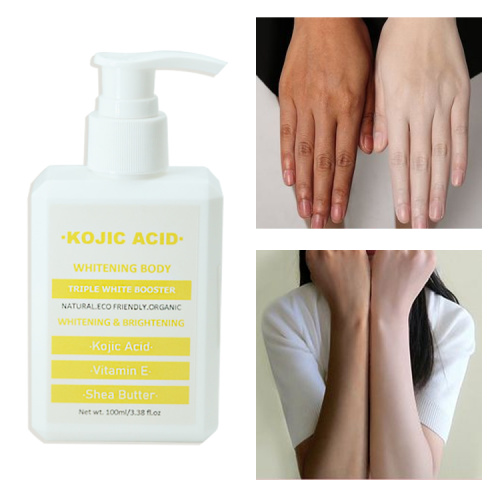 kojic acid body cream whitening body lotion