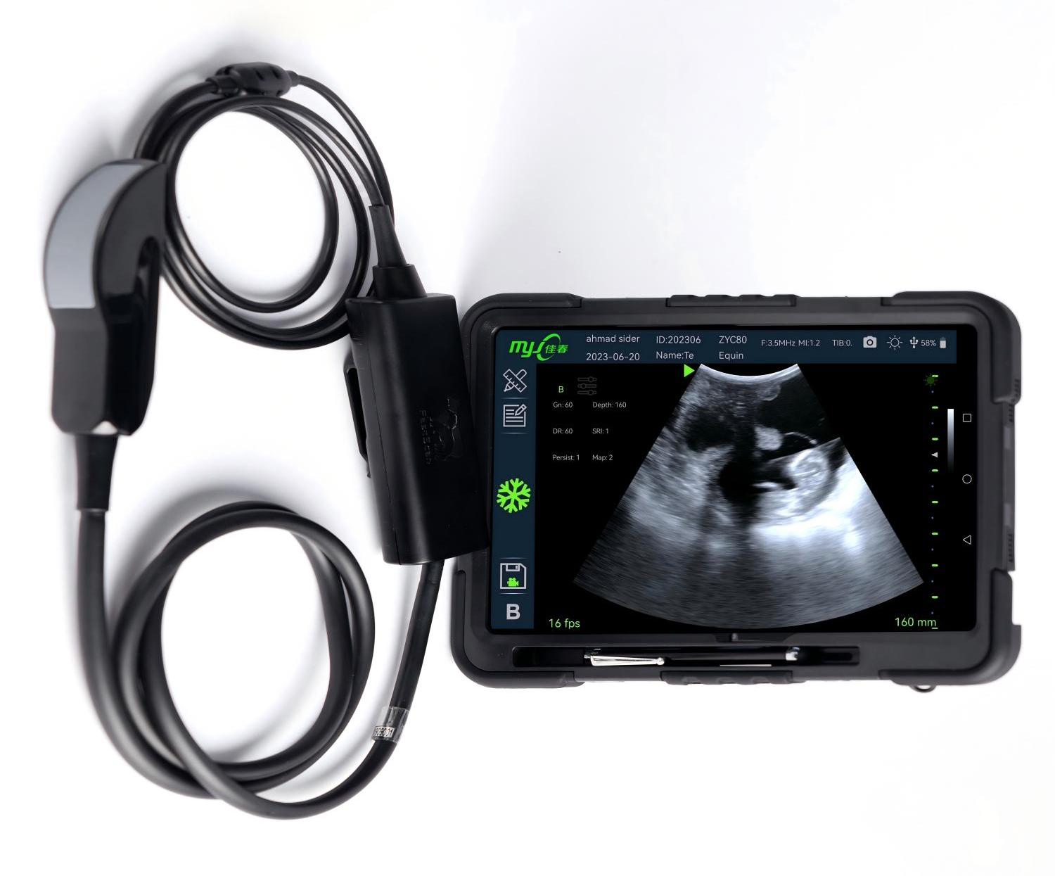 best ultrasound machine brands