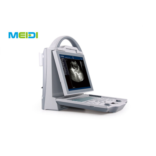 Full Digital B Mode Ultrasound Scanner