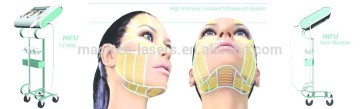 High Intensity Focused Ultrasound System