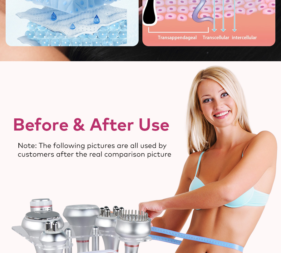 cavitation body sculpting