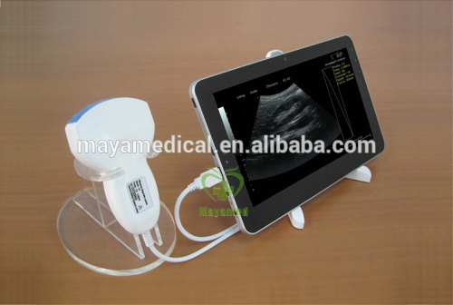 MY-A010A USB Portable Ultrasound Diagnostic System
