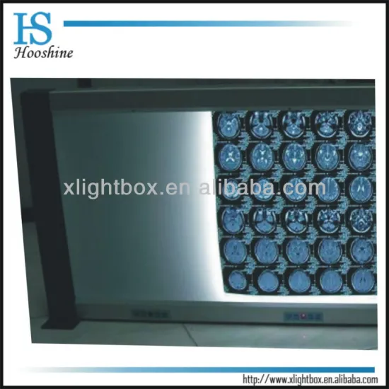 Four bank medical film viewbox/self-induction